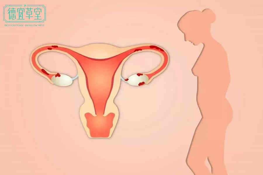流产后吃燕窝能促进子宫修复吗